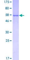 Human ALDOB Protein (Recombinant GST)