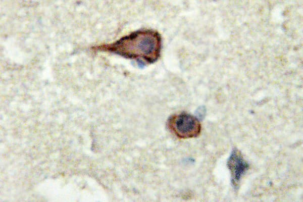 Basigin / Emmprin / CD147 Antibody (Gln370)