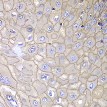 Polyclonal Rabbit anti-Human ANXA1 / Annexin A1 Antibody (IHC, IF, WB)