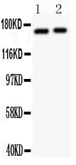 GRIN2A / NMDAR2A / NR2A Antibody (aa1411-1427)
