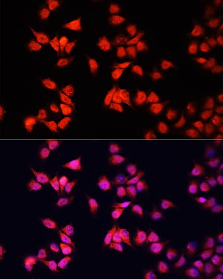BRCA1 Antibody