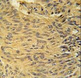 LCLAT1 Antibody (aa296-324)