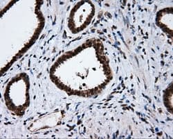 SRR / Serine Racemase Antibody (clone OTI7E8, Carrier-free)