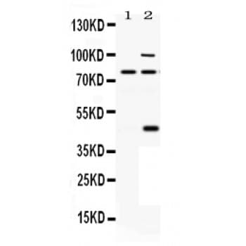 PACE4 / PCSK6 Antibody (aa614-651)