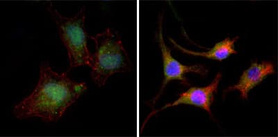 IHC-plus™ CTNNB1 / Beta Catenin Antibody (clone 4D5)