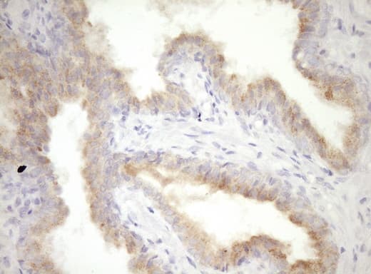 CPM / Carboxypeptidase M Antibody (aa124-423, clone OTI8E2)
