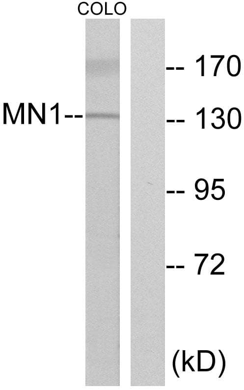 SMN1/SMN2 Antibody