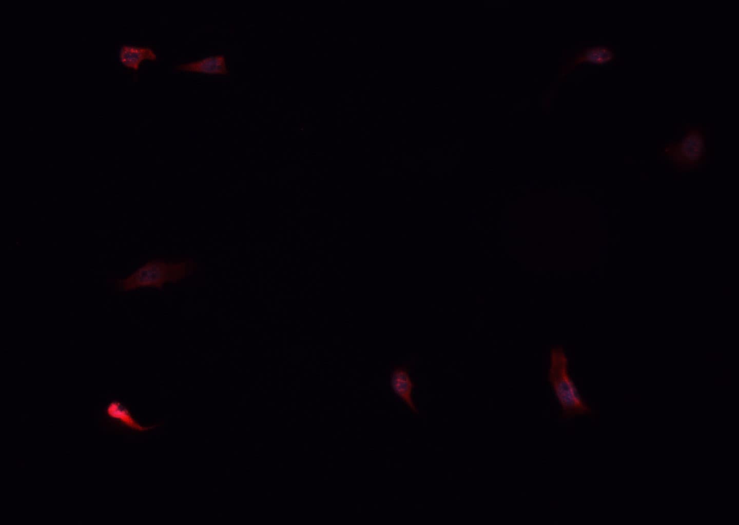 MCL1 / MCL 1 Antibody