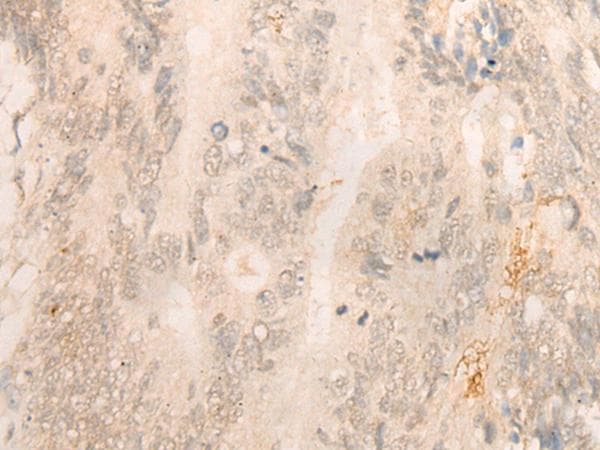 FBXO32 / Fbx32 Antibody