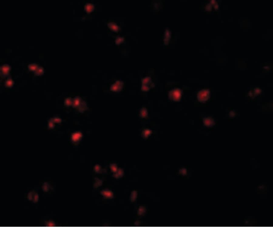 IHC-plus™ Polyclonal Rabbit anti-Human CD225 / IFITM1 Antibody (IHC, IF, WB)