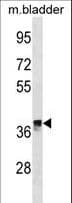 CRYM Antibody (aa154-183)