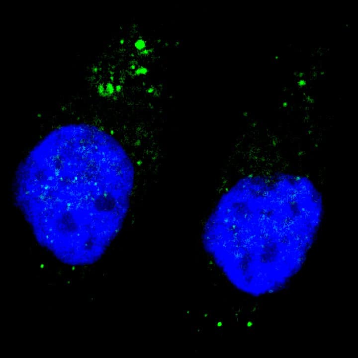 ULK1 Antibody (phospho-Ser556)