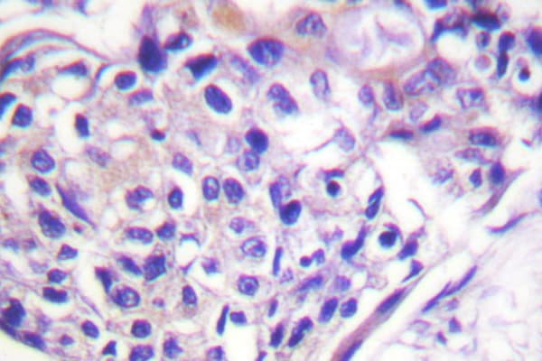 FOXO1 / FKHR Antibody (phospho-Ser329)