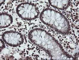 CHN1 Antibody (clone OTI2G6)