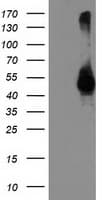TMPRSS5 Antibody (clone OTI4A11)