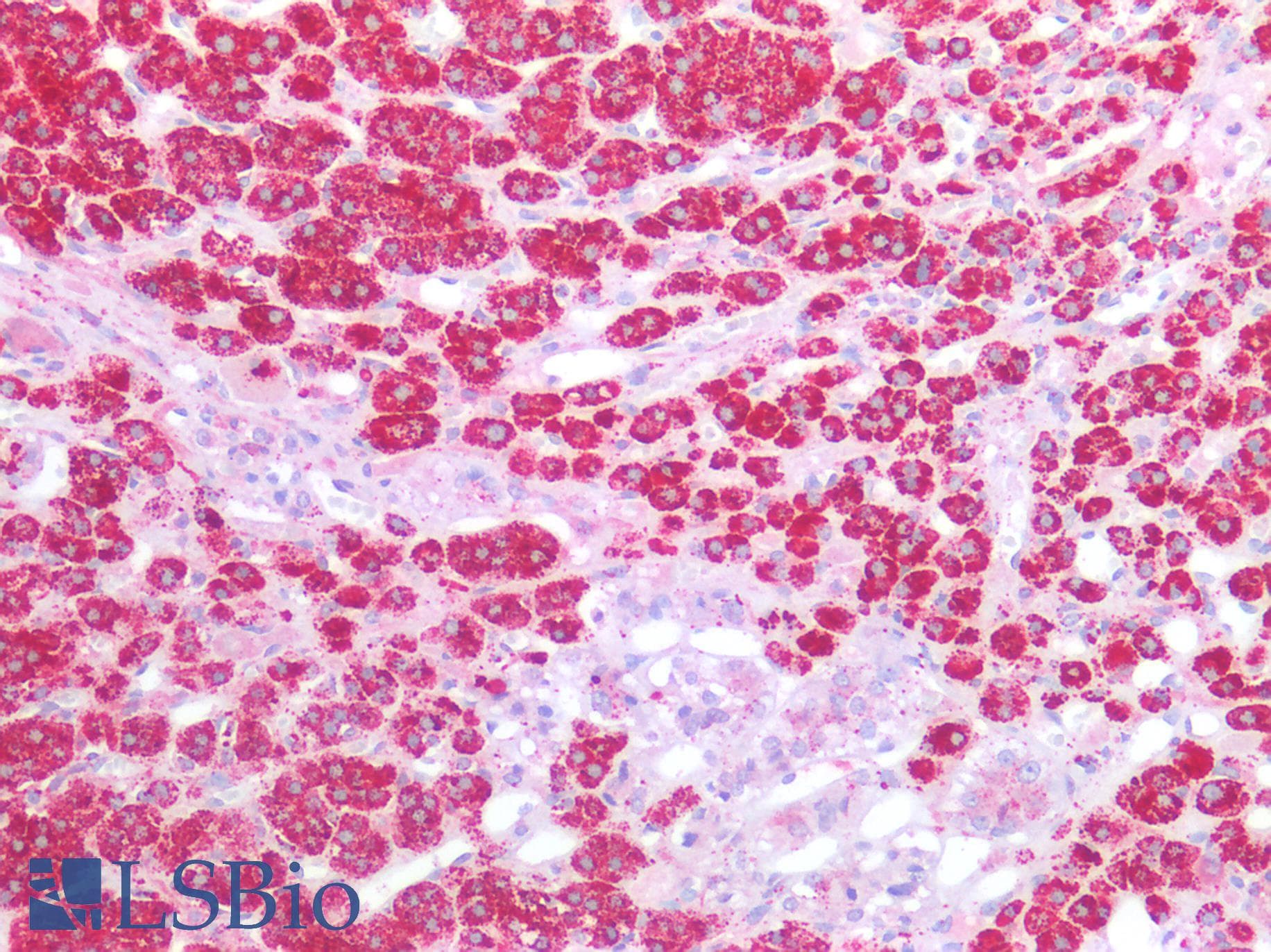 PathPlus™ NPTX1 Antibody