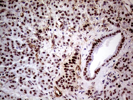 NSD3 / WHSC1L1 Antibody (aa427-566, clone OTI3B3)