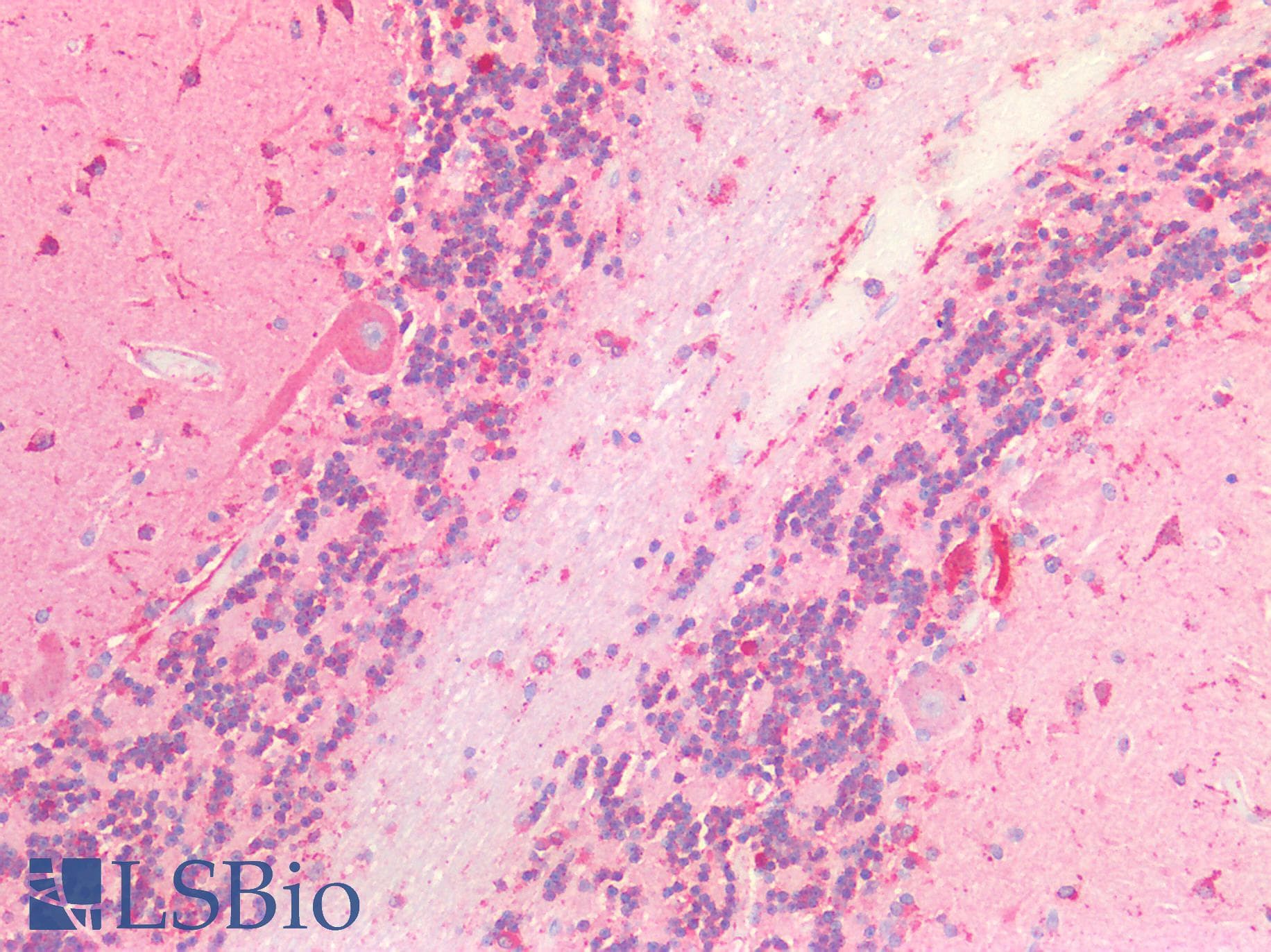 IHC-plus™ Polyclonal Rabbit anti-Human CTSB / Cathepsin B Antibody (IHC)
