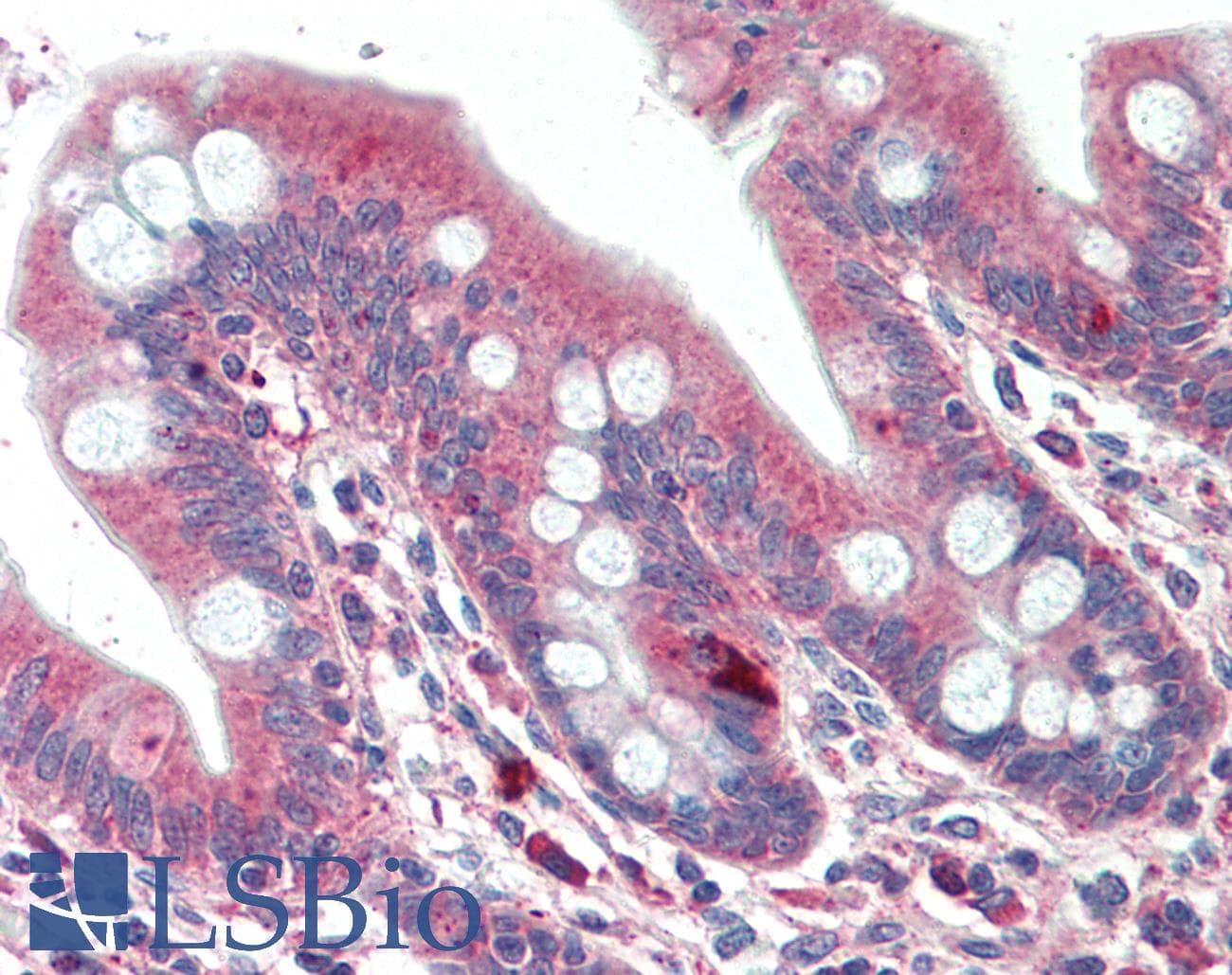IHC-plus™ Polyclonal Goat anti-Human DTX2 Antibody (aa417-430, IHC)