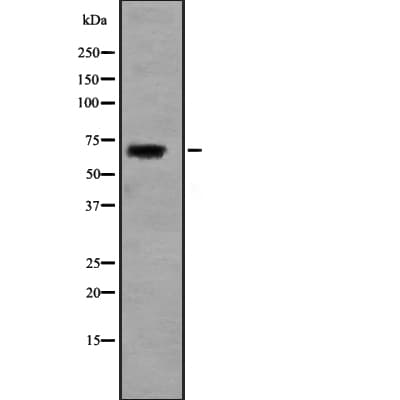 Polyclonal Rabbit anti-Human SLC5A5 / NIS Antibody (IHC, WB)