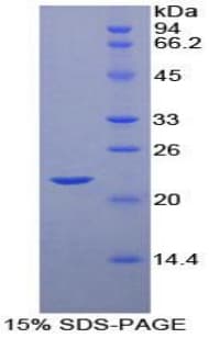 Human POTEG Protein (Recombinant His)