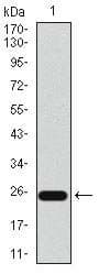 ITGB4 / Integrin Beta 4 Antibody (Amino Acid: 1619-1822, clone 10B10D5)