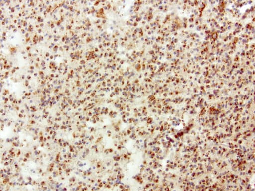 Monoclonal Mouse anti-Human SQSTM1 Antibody (clone UMAB12, Carrier-free, IHC, IF, WB)