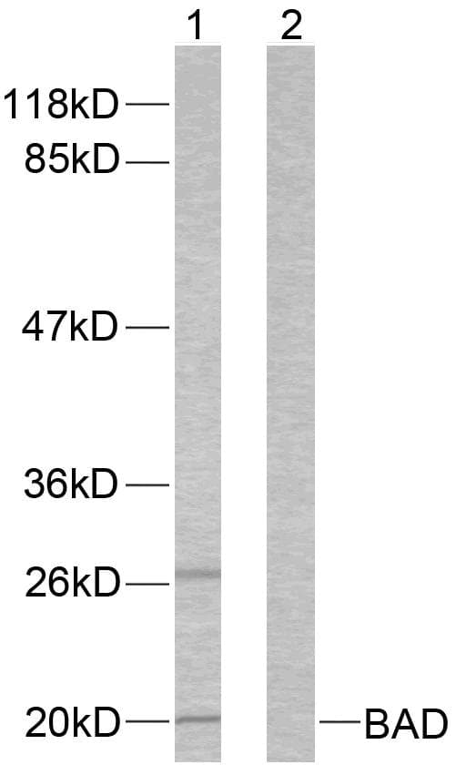 Polyclonal Rabbit anti-Human BAD Antibody (p136, IHC, WB)