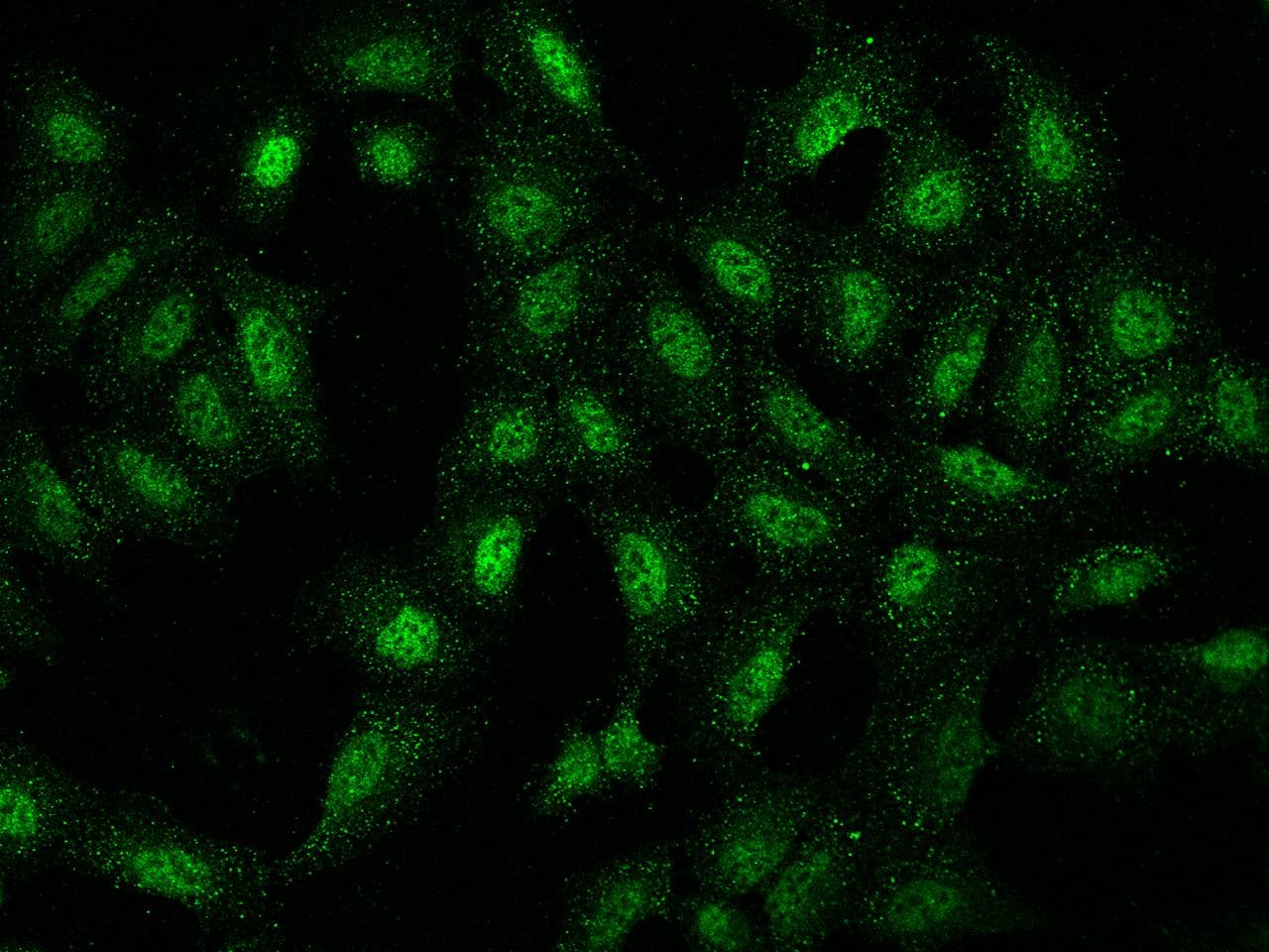 Polyclonal Rabbit anti-Human NUP188 Antibody (IF)