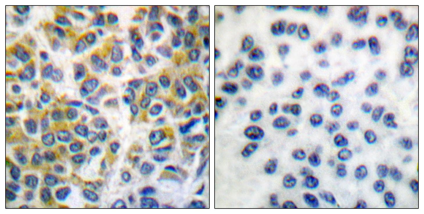 Polyclonal Rabbit anti-Human PTPN6 / SHP1 Antibody (p536, IHC, WB)