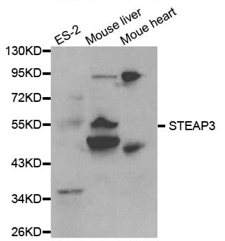 IHC-plus™ TSAP6 / STEAP3 Antibody
