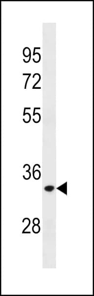 ELOVL3 Antibody (aa241-270)