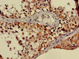 Polyclonal Rabbit anti-Human PPP2R3A / PR130 Antibody (IHC)