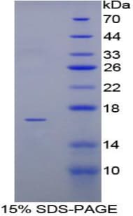 Pig LTA / TNF Beta Protein (Recombinant His-T7)
