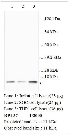RPL37 / Ribosomal Protein L37 Antibody