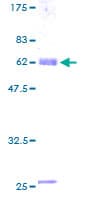 Human ENOX2 Protein (Recombinant GST)
