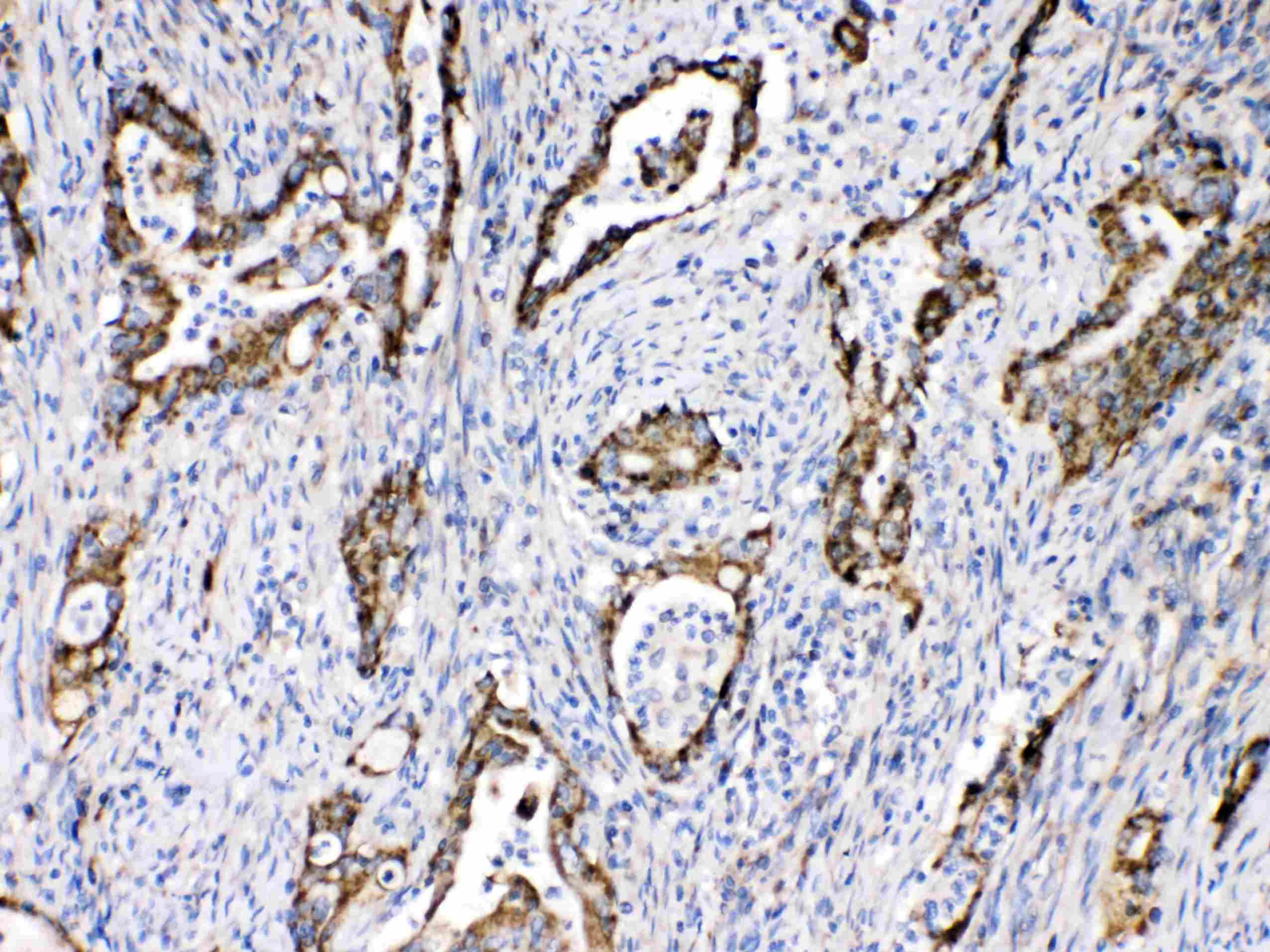 Polyclonal Rabbit anti-Human TECTA Antibody (IHC, WB)