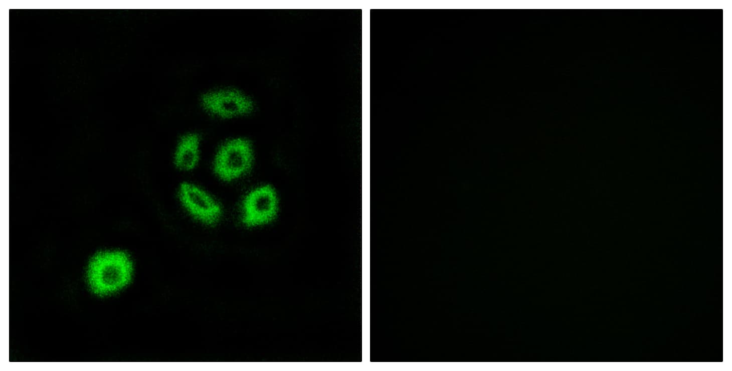 Polyclonal Rabbit anti-Human FBLN2 / Fibulin 2 Antibody (aa241-290, IHC, IF)