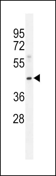 Polyclonal Rabbit anti-Human MOGAT3 Antibody (aa295-329, WB)