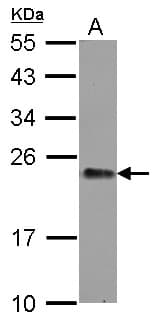 Gpnat1 / GNPNAT1 Antibody