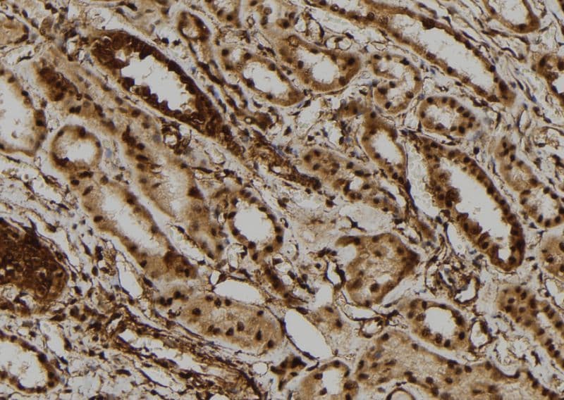 DHX9 Antibody