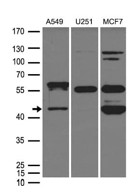 ZP3 Antibody