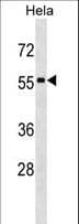 STAU1 / Staufen Antibody (aa27-55)