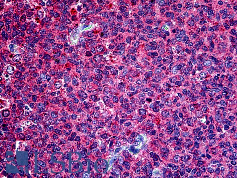 IHC-plus™ Securin / PTTG1 Antibody (aa148-160)