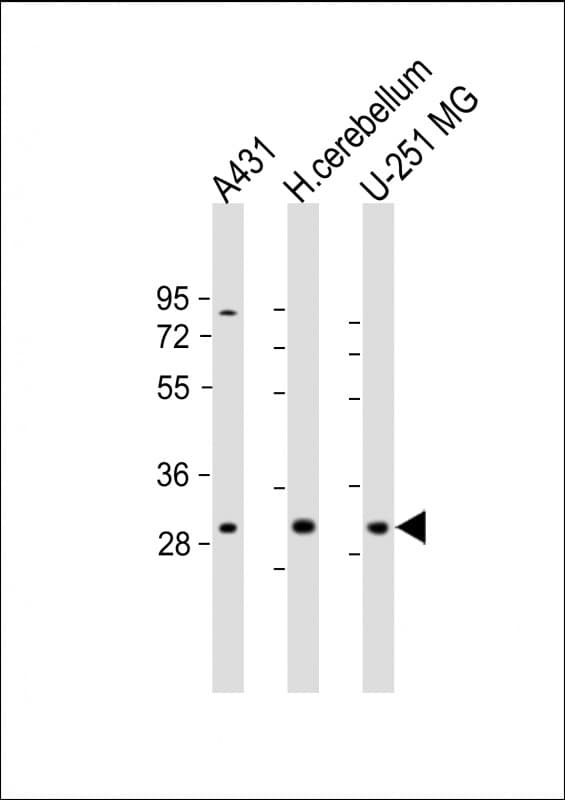 BCDIN3D Antibody (C-Terminus)
