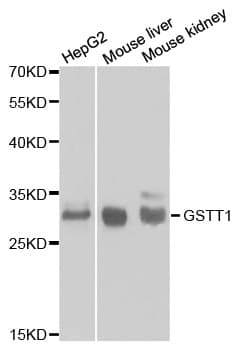 Polyclonal Rabbit anti-Human GSTT1 Antibody (IHC, WB)