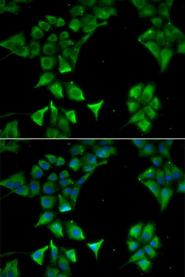 IHC-plus™ CD177 Antibody