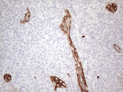 CD34 Antibody (aa312-385, clone OTI11E1)