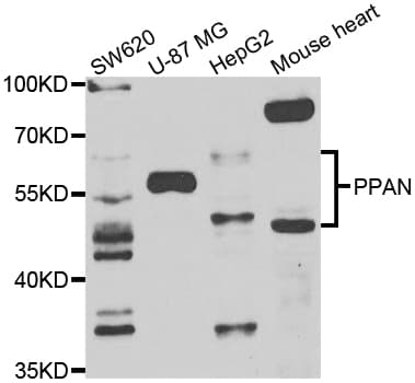 Polyclonal Rabbit anti-Human PPAN Antibody (IHC, IF, WB)