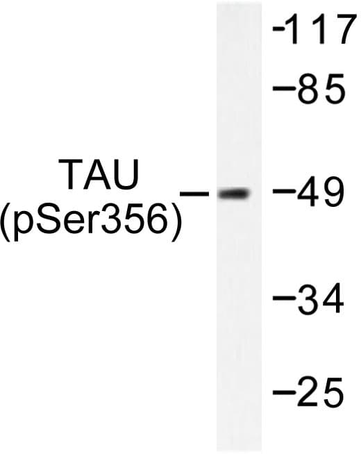 MAPT / Tau Antibody (phospho-Ser356)